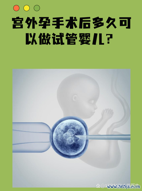 试管婴儿,要多,长时间