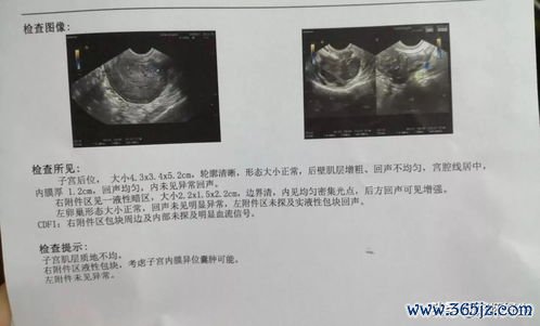 做试管婴儿要打多少针，促排卵针全记录