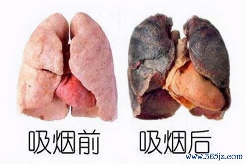 慢阻肺：长期吸烟者有这个症状？肺功能已经损伤了