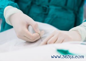 做试管婴儿需多少钱