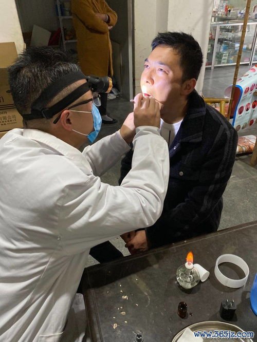 扁桃体,肥大,打呼噜