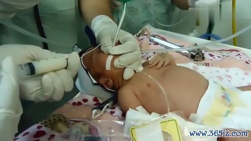 早产儿：提前出来的宝宝，怎么养