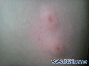 解毒杀虫燥湿止痒药，疥癣湿疹虫蛇伤