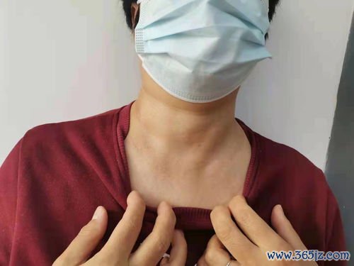 桥本氏病：最常见的甲减病因，抗体攻击甲状腺