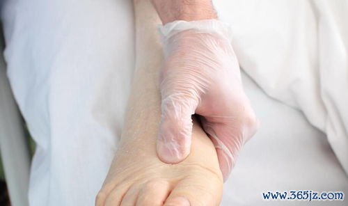 淋巴水肿：乳腺癌术后胳膊肿，怎么消
